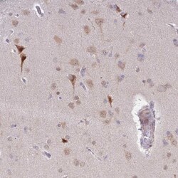 MLLT11 Antibody, Novus Biologicals:Antibodies:Primary Antibodies